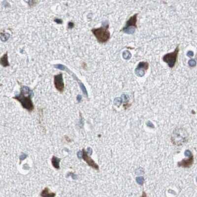 Immunohistochemistry-Paraffin: PITRM1 Antibody [NBP1-81728]