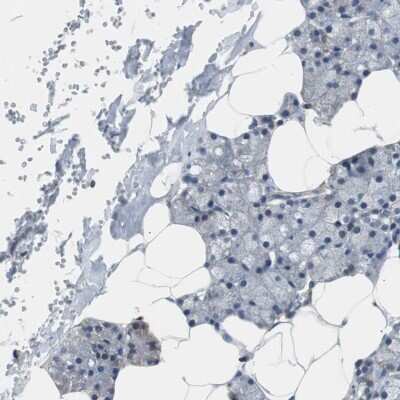 Immunohistochemistry-Paraffin: PITRM1 Antibody [NBP1-81729]