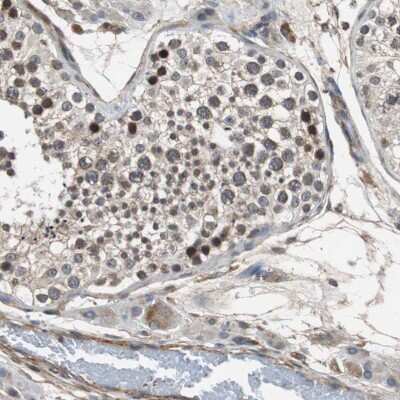 Immunohistochemistry-Paraffin: PITRM1 Antibody [NBP1-81729]