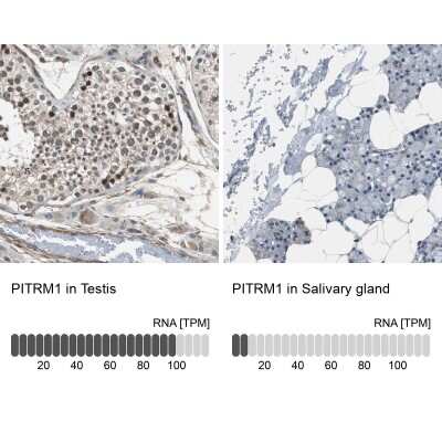 Immunohistochemistry-Paraffin: PITRM1 Antibody [NBP1-81729]