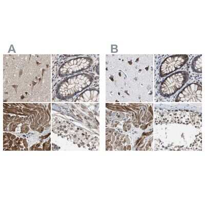 Immunohistochemistry-Paraffin: PITRM1 Antibody [NBP1-81729]