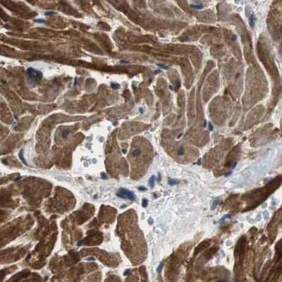 Immunohistochemistry-Paraffin: PITRM1 Antibody [NBP1-81729]