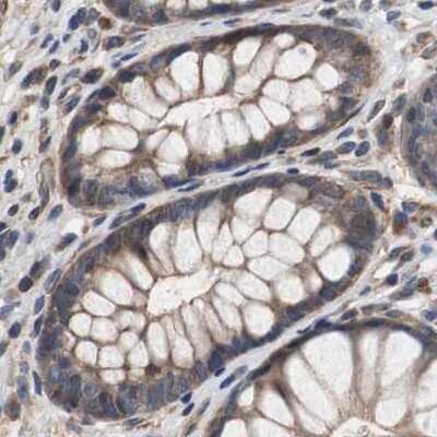 Immunohistochemistry-Paraffin: PITRM1 Antibody [NBP1-81729]