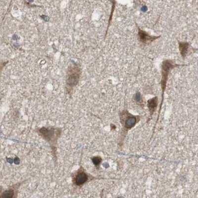 Immunohistochemistry-Paraffin: PITRM1 Antibody [NBP1-81729]