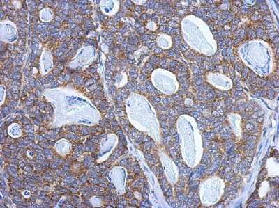 Immunohistochemistry-Paraffin: PITRM1 Antibody [NBP2-19844]