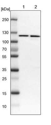 Western Blot: PITRM1 Antibody [NBP1-81728]