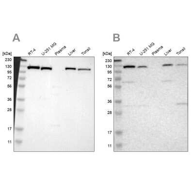 Western Blot: PITRM1 Antibody [NBP1-81728]
