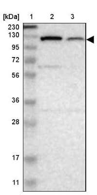 Western Blot: PITRM1 Antibody [NBP1-81729]