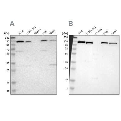 Western Blot: PITRM1 Antibody [NBP1-81729]