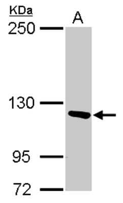 Western Blot: PITRM1 Antibody [NBP2-19843]