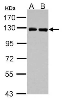 Western Blot: PITRM1 Antibody [NBP2-19844]