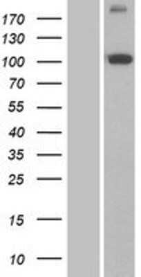 Western Blot: PITRM1 Overexpression Lysate [NBP2-07258]