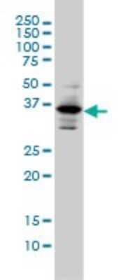 Western Blot: PITX1 Antibody (5G4) [H00005307-M01]
