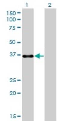 Western Blot: PITX1 Antibody (5G4) [H00005307-M01]