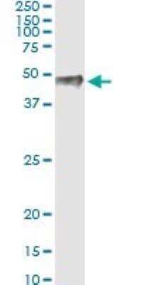 Western Blot: PITX1 Antibody (5G4) [H00005307-M01]