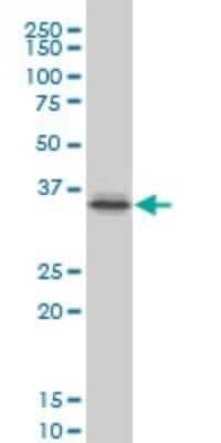 Western Blot: PITX1 Antibody (6D4) [H00005307-M02]