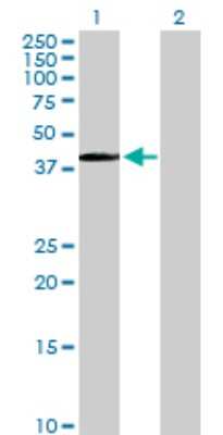 Western Blot: PITX1 Antibody [H00005307-D01P]