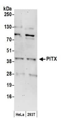 Western Blot: PITX1 Antibody [NB100-1546]