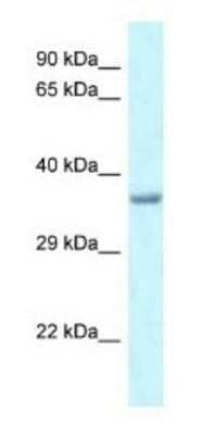 Western Blot: PITX1 Antibody [NBP1-82383]