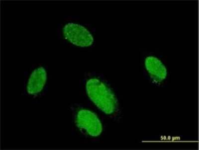 Immunocytochemistry/ Immunofluorescence: PITX2 Antibody (2G6) [H00005308-M01]