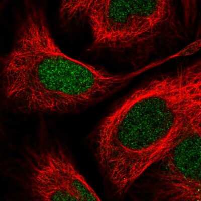 Immunocytochemistry/ Immunofluorescence: PITX2 Antibody [NBP2-55572]