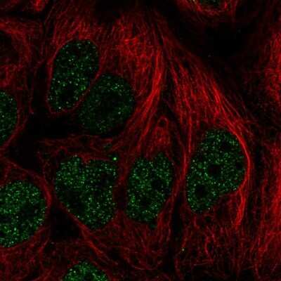 Immunocytochemistry/ Immunofluorescence: PITX2 Antibody [NBP2-57409]