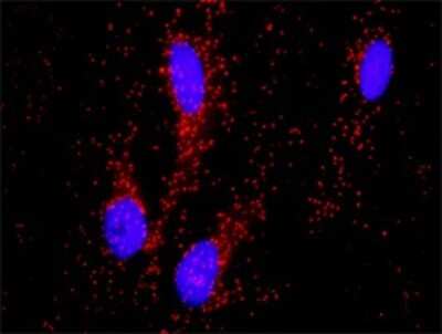 Proximity Ligation Assay: PITX2 Antibody [H00005308-D01P]