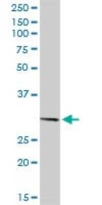 Western Blot: PITX2 Antibody [H00005308-D01P]