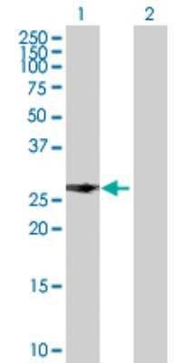Western Blot: PITX2 Antibody [H00005308-D01P]