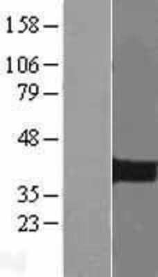 Western Blot: PITX2 Overexpression Lysate [NBL1-14446]