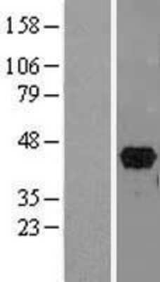 Western Blot: PITX2 Overexpression Lysate [NBL1-14447]