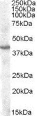 Western Blot: PITX3 Antibody [NB100-96910]