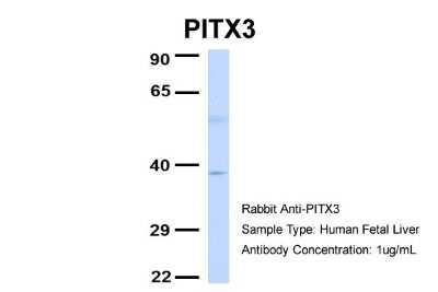 Western Blot: PITX3 Antibody [NBP2-85479]