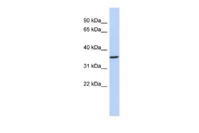 Western Blot: PITX3 Antibody [NBP2-85481]