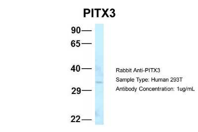 Western Blot: PITX3 Antibody [NBP2-85481]