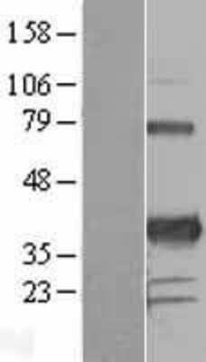 Western Blot: PITX3 Overexpression Lysate [NBL1-14449]