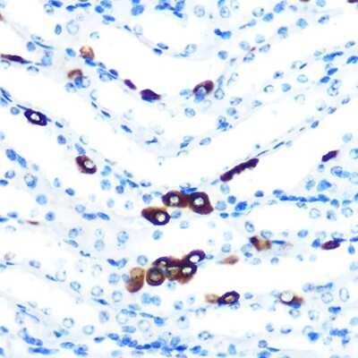 Immunohistochemistry-Paraffin: PIWIL1/HIWI Antibody (0H5A4) [NBP3-16200]