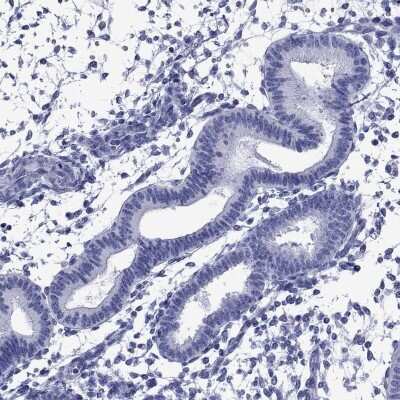 Immunohistochemistry-Paraffin: PIWIL1/HIWI Antibody [NBP3-17007]