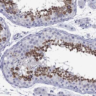 Immunohistochemistry-Paraffin: PIWIL1/HIWI Antibody [NBP3-17007]