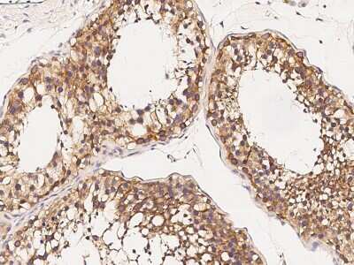 Immunohistochemistry-Paraffin: PIWIL2 Antibody [NBP2-98711]