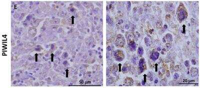 Immunohistochemistry: PIWIL4 Antibody [NBP1-83491]