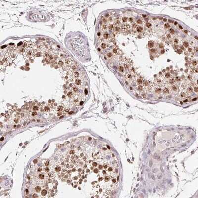 Immunohistochemistry: PIWIL4 Antibody [NBP2-49258]