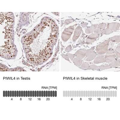 Immunohistochemistry-Paraffin: PIWIL4 Antibody [NBP2-49258]