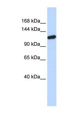 Western Blot: PIWIL4 Antibody [NBP1-54343]