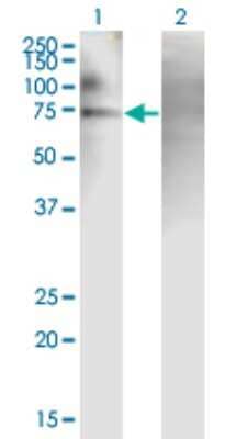 Western Blot: PJA2/Praja2 Antibody (1G11) [H00009867-M01]