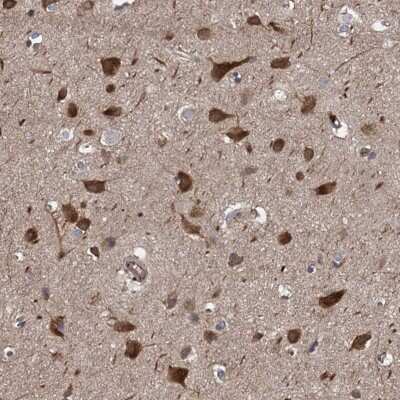 Immunohistochemistry-Paraffin: PJA2/Praja2 Antibody [NBP1-83006]