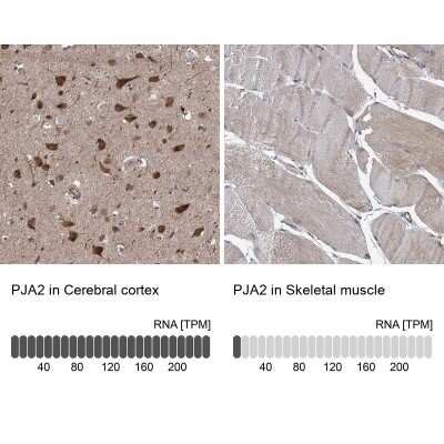 Immunohistochemistry-Paraffin: PJA2/Praja2 Antibody [NBP1-83006]