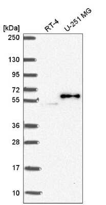 Western Blot: PJA2/Praja2 Antibody [NBP2-56901]