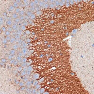 Immunohistochemistry-Paraffin: PKA 2 beta Antibody (2U2P1) [NBP3-15890]