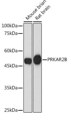 Western Blot: PKA 2 beta Antibody (2U2P1) [NBP3-15890]